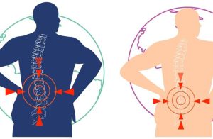 Explore drug-free solutions for back and spine pain relief. Embrace natural remedies like proper posture, targeted exercises, and hot/cold therapy.